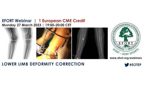 EFORT WEBINAR MARCH 2023: LOWER LIMB DEFORMITY CORRECTION